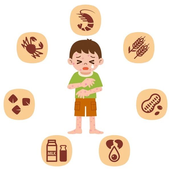 Dia Mundial da Alergia: 8 de julho alerta para sinais e cuidados com reações alérgicas na infância
