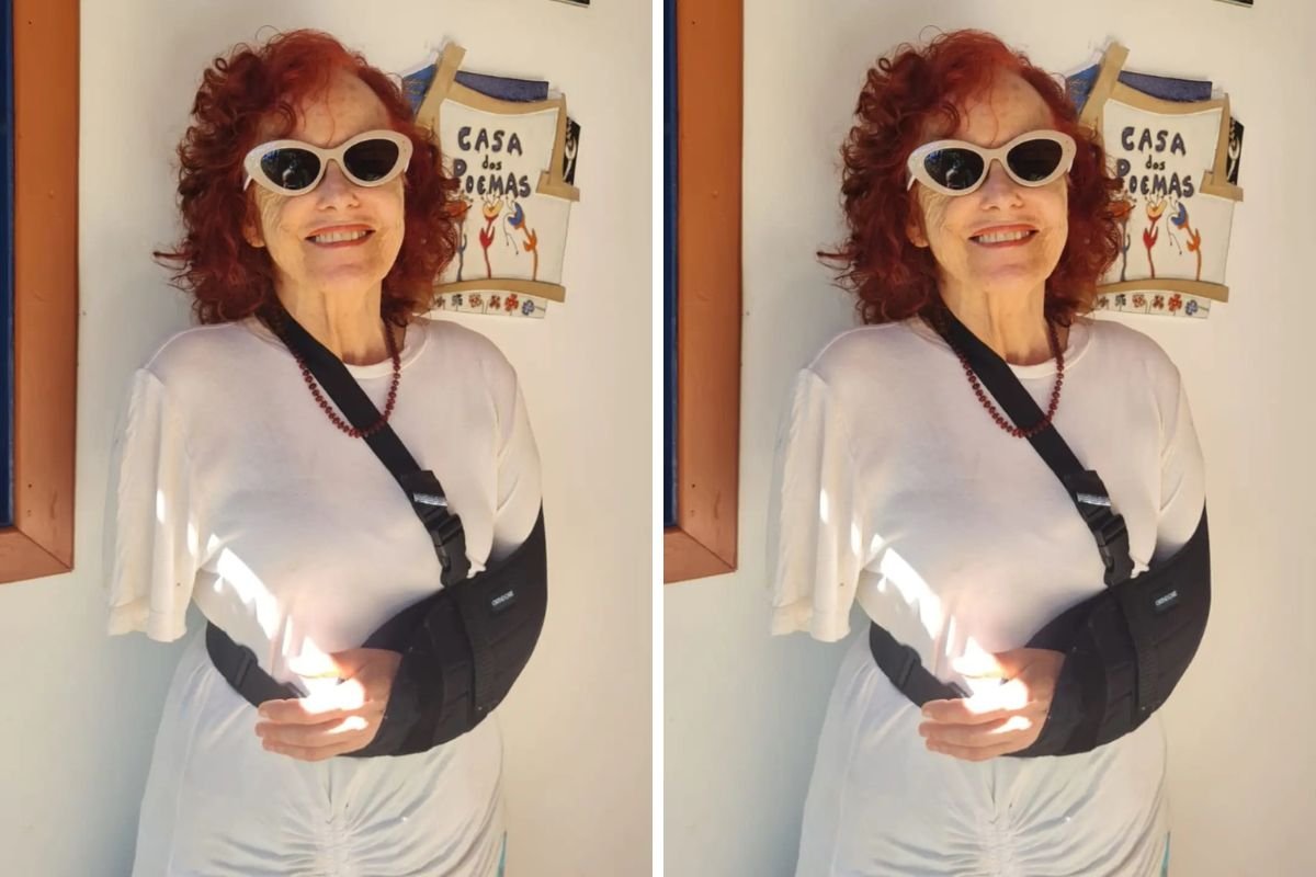 Depois ataque de pitbulls, escritora sofre acidente doméstico